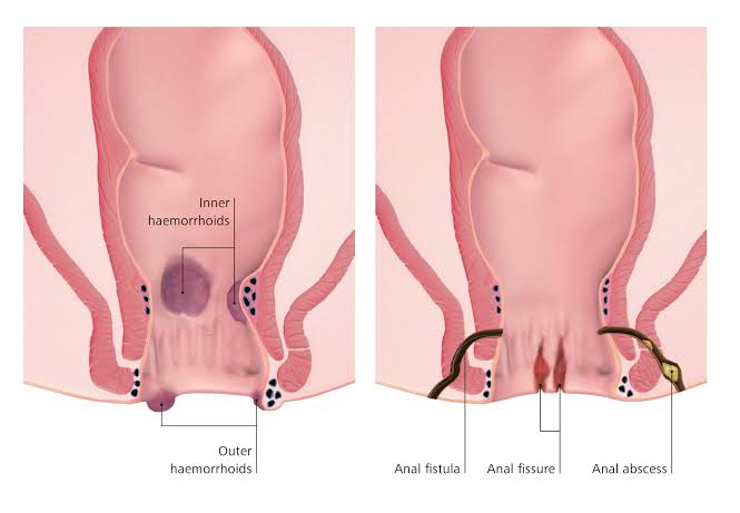 jio joints pain center